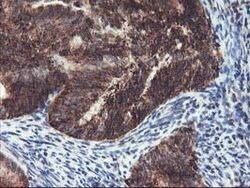 TRAP1 Mouse anti-Canine, Human, Mouse, Rat, Clone: OTI1A1, lyophilized,