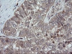 TRAPPC4 Monoclonal Antibody (OTI2E1), TrueMAB , OriGene 100 &mu;L; Unconjugated:Antibodies,
