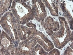 TRAPPC4 Monoclonal Antibody (OTI2E1), TrueMAB , OriGene 100 &mu;L; Unconjugated:Antibodies,