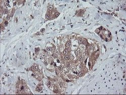 TRAPPC4 Monoclonal Antibody (OTI2E1), TrueMAB , OriGene 100 &mu;L; Unconjugated:Antibodies,