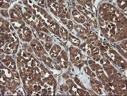 TRAPPC4 Monoclonal Antibody (OTI2G8), TrueMAB , OriGene 100 &mu;L; Unconjugated:Antibodies,