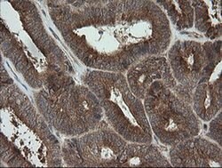 TRAPPC4 Monoclonal Antibody (OTI2G8), TrueMAB , OriGene 100 &mu;L; Unconjugated:Antibodies,