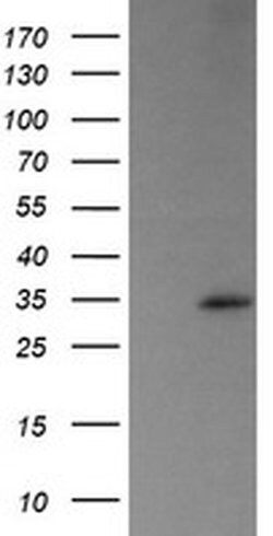 TRAPPC4 Monoclonal Antibody (OTI2E1), TrueMAB , OriGene 100 &mu;L; Unconjugated:Antibodies,