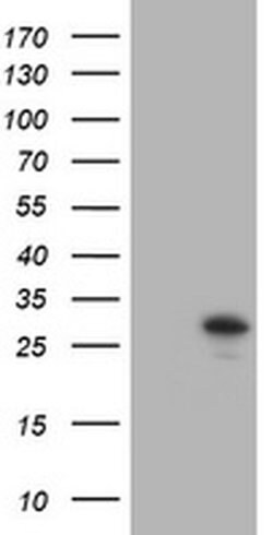 TRAPPC4 Monoclonal Antibody (OTI1A3), TrueMAB , OriGene 100 &mu;L; Unconjugated:Antibodies,
