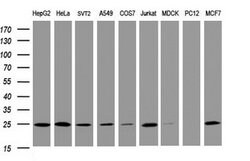 TRAPPC4 Mouse anti-Human, Clone: OTI1A3, lyophilized, TrueMAB 100 &mu;g;