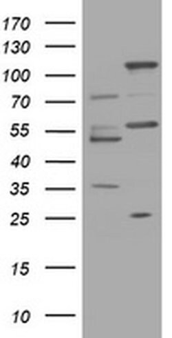 TRAPPC4 Monoclonal Antibody (OTI3A8), TrueMAB , OriGene:Antibodies:Primary
