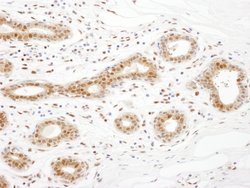 TRAX Rabbit anti-Human, Polyclonal, Bethyl Laboratories 100 &mu;L; Unconjugated:Antibodies,