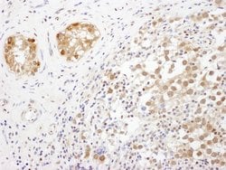 TRAX Rabbit anti-Human, Polyclonal, Bethyl Laboratories 100 &mu;L; Unconjugated:Antibodies,
