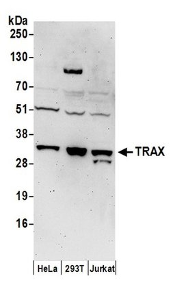 TRAX Rabbit anti-Human, Polyclonal, Bethyl Laboratories 100 &mu;L; Unconjugated:Antibodies,