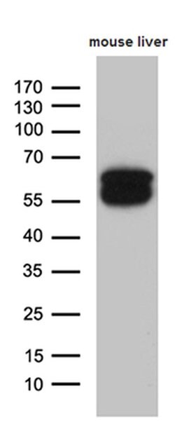 TRDMT1 Monoclonal Antibody (OTI8H10), TrueMAB , OriGene 100 &mu;L | Buy Online | OriGene | Fisher Scientific