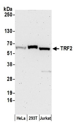 TRF2 Rabbit anti-Human, Polyclonal, Bethyl Laboratories 100 &mu;L; Unconjugated:Antibodies,