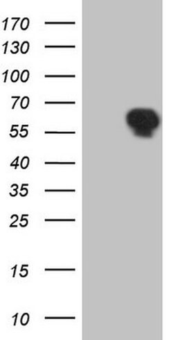 TRIB1 Mouse anti-Human, Clone: OTI1F11, lyophilized, TrueMAB 100 &mu;g;