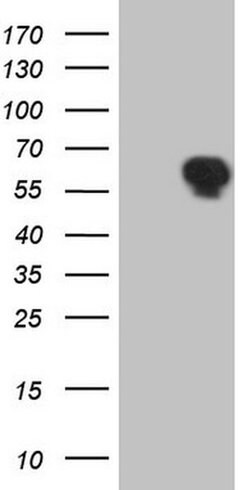 TRIB1 Monoclonal Antibody (OTI1F11), TrueMAB , OriGene 30 &mu;L | Buy Online | Origene Technologies | Fisher Scientific