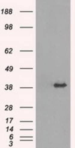 TRIB2 Mouse anti-Human, Clone: OTI8D11, lyophilized, TrueMAB 100 &mu;g | Buy Online | Origene Technologies | Fisher Scientific