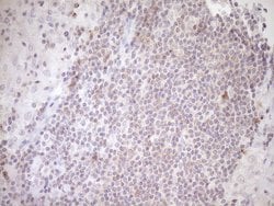 TRIB3 Monoclonal Antibody (OTI2D11), TrueMAB , OriGene 100 &mu;L; Unconjugated:Antibodies,