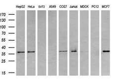 TRIB3 Monoclonal Antibody (OTI3F6), TrueMAB , OriGene 100 &mu;L; Unconjugated:Antibodies,