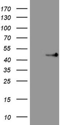 TRIB3 Monoclonal Antibody (OTI3G4), TrueMAB , OriGene:Antibodies:Primary