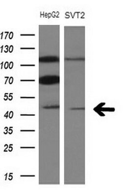 TRIB3 Monoclonal Antibody (OTI3F3), TrueMAB , OriGene 100 &mu;L; Unconjugated:Antibodies,