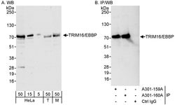 TRIM16/EBBP Rabbit anti-Human, Mouse, Polyclonal, Bethyl Laboratories 100