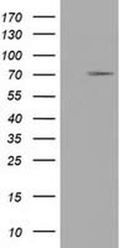 TRIM2 Monoclonal Antibody (OTI4E5), TrueMAB , OriGene:Antibodies:Primary