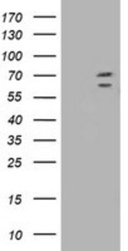 TRIM2 Mouse anti-Human, Clone: OTI2B10, lyophilized, TrueMAB 100 &mu;g;
