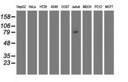 TRIM2 Mouse anti-Human, Clone: OTI2B10, TrueMAB , Origene 30 &mu;L; Unconjugated:Antibodies,