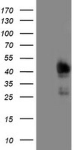 TRIM24 Mouse anti-Human, Clone: OTI1A2, lyophilized, TrueMAB 100 &mu;g;