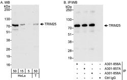 TRIM25 Rabbit anti-Human, Polyclonal, Bethyl Laboratories 100 &mu;L; Unconjugated:Antibodies,