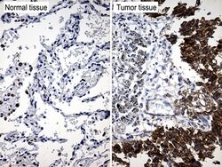 TRIM29 Monoclonal Antibody (OTI8D12), TrueMAB , OriGene 100 &mu;L; Unconjugated:Antibodies,