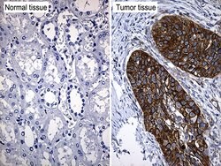 TRIM29 Monoclonal Antibody (OTI8D12), TrueMAB , OriGene 100 &mu;L; Unconjugated:Antibodies,