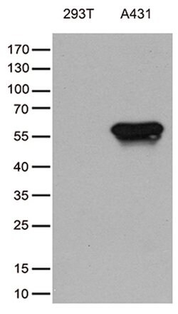 TRIM29 Monoclonal Antibody (OTI8D12), TrueMAB , OriGene 100 &mu;L; Unconjugated:Antibodies,