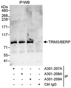 TRIM3/BERP Rabbit anti-Human, Polyclonal, Bethyl Laboratories 100 &mu;L;