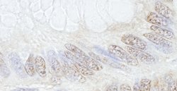 TRIM33/TIF1gamma Polyclonal Antibody, Bethyl Laboratories 100 &mu;L; Unconjugated:Antibodies,