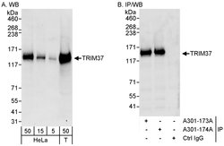 TRIM37 Rabbit anti-Human, Polyclonal, Bethyl Laboratories 100 &mu;L; Unconjugated:Antibodies,