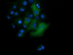 TRIM38 Monoclonal Antibody (OTI15B10), TrueMAB , OriGene 100 &mu;L; Unconjugated:Antibodies,
