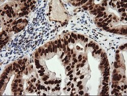 TRIM38 Mouse anti-Human, Clone: OTI113D3, lyophilized, TrueMAB 100 &mu;g;