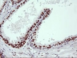 TRIM38 Mouse anti-Human, Clone: OTI113D3, lyophilized, TrueMAB 100 &mu;g;