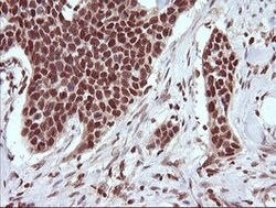 TRIM38 Mouse anti-Human, Clone: OTI113D3, lyophilized, TrueMAB 100 &mu;g;