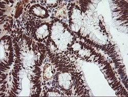 TRIM38 Mouse anti-Human, Clone: OTI113D3, lyophilized, TrueMAB 100 &mu;g;