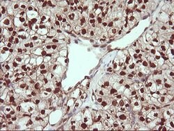 TRIM38 Mouse anti-Human, Clone: OTI113D3, lyophilized, TrueMAB 100 &mu;g;