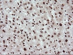 TRIM38 Mouse anti-Human, Clone: OTI113D3, lyophilized, TrueMAB 100 &mu;g;