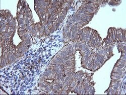 TRIM38 Monoclonal Antibody (OTI14B4), TrueMAB , OriGene 100 &mu;L; Unconjugated:Antibodies,