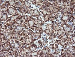TRIM38 Monoclonal Antibody (OTI14B4), TrueMAB , OriGene:Antibodies:Primary
