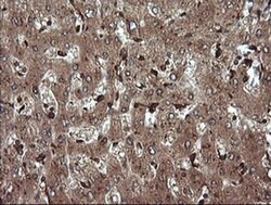 TRIM38 Monoclonal Antibody (OTI14B4), TrueMAB , OriGene 100 &mu;L; Unconjugated:Antibodies,