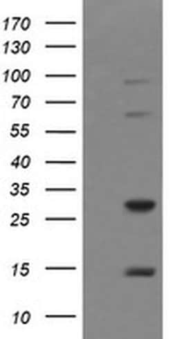TRIM38 Monoclonal Antibody (OTI1B9), TrueMAB , OriGene 100 &mu;L; Unconjugated:Antibodies,
