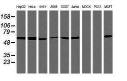 TRIM38 Monoclonal Antibody (OTI15H4), TrueMAB , OriGene 100 &mu;L | Buy Online | Origene Technologies | Fisher Scientific