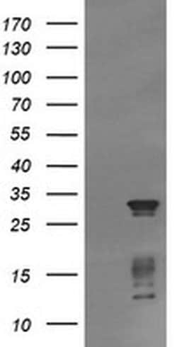 TRIM38 Monoclonal Antibody (OTI15B10), TrueMAB , OriGene 100 &mu;L; Unconjugated:Antibodies,
