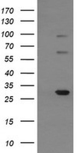 TRIM38 Monoclonal Antibody (OTI16D9), TrueMAB , OriGene 100 &mu;L | Buy Online | Origene Technologies | Fisher Scientific