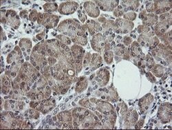 TRIM44 Monoclonal Antibody (OTI5C2), TrueMAB , OriGene 100 &mu;L; Unconjugated:Antibodies,
