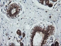 TRIM44 Mouse anti-Human, Clone: OTI1E10, lyophilized, TrueMAB 100 &mu;g;